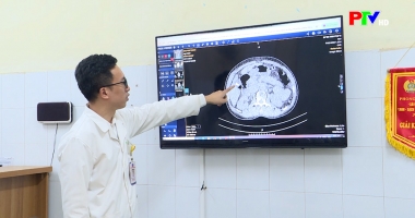 Sống khỏe mỗi ngày - Sỏi túi mật